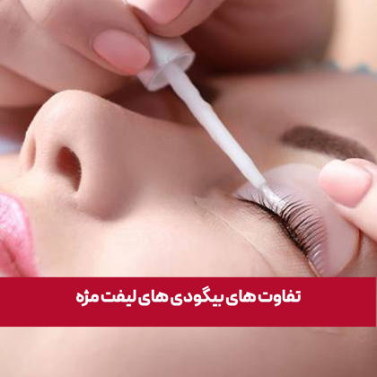 تفاوت بیگودی های لیفت مژه
