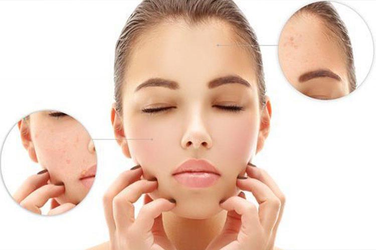 بهترین کرم‌ های لایه بردار برای جای جوش در بازار
